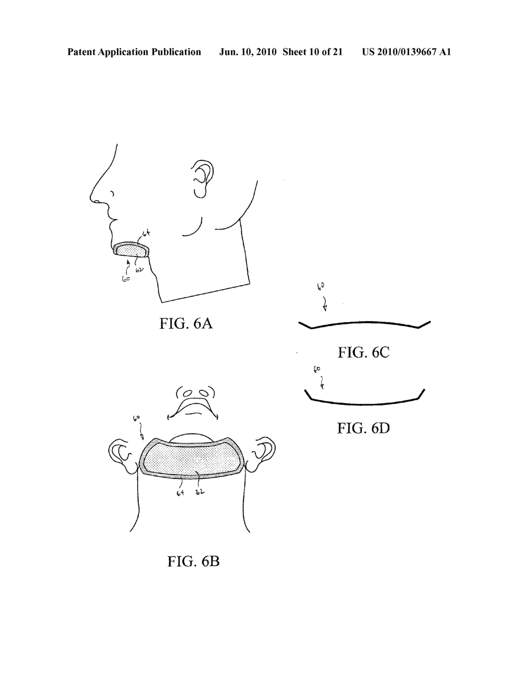 DEVICES AND METHODS FOR TREATING SLEEP DISORDERS - diagram, schematic, and image 11