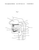 Method and Device For Treatment Of Obstructive Sleep Apnea diagram and image