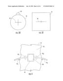 SURGICAL DRAPES WITH PATCHES TO PROVIDE PORTS diagram and image