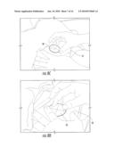 SURGICAL DRAPES WITH PATCHES TO PROVIDE PORTS diagram and image