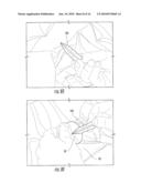 SURGICAL DRAPES WITH PATCHES TO PROVIDE PORTS diagram and image