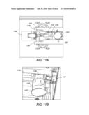 Modular, Portable Dialysis System diagram and image