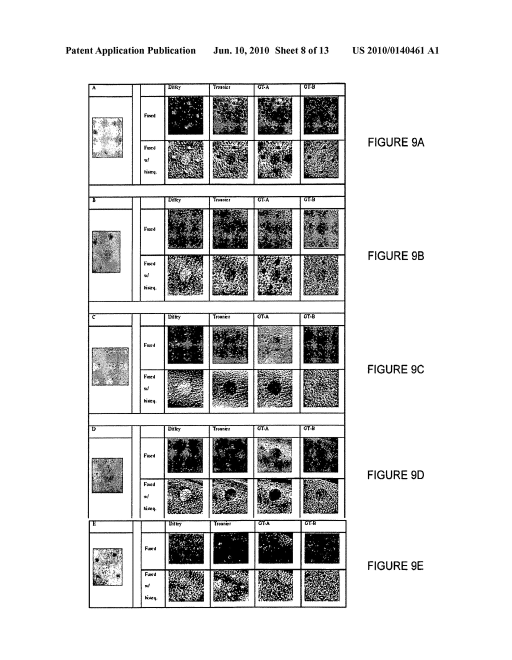 SYSTEMS AND METHODS FOR REAL TIME MULTISPECTRAL IMAGING - diagram, schematic, and image 09