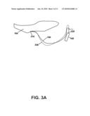 METHOD AND APPARATUS FOR CONTROLLING THE EFFECTS OF SEEK-INDUCED VIBRATION OF A COMPONENT PART IN A HARD-DISK DRIVE diagram and image