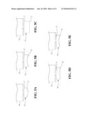 Auxiliary Positioning Device For Ultrasonic Apparatus diagram and image