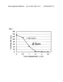 DYNAMIC TUMOR RADIATION TREATMENT APPARATUS AND PROGRAM diagram and image