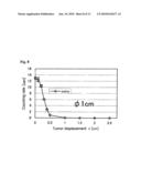 DYNAMIC TUMOR RADIATION TREATMENT APPARATUS AND PROGRAM diagram and image