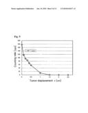 DYNAMIC TUMOR RADIATION TREATMENT APPARATUS AND PROGRAM diagram and image