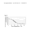 DYNAMIC TUMOR RADIATION TREATMENT APPARATUS AND PROGRAM diagram and image