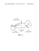 MINIMALLY INVASIVE PARTICLE BEAM CANCER THERAPY APPARATUS diagram and image