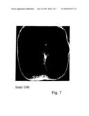 Method and Device for Evaluating Fluorescence Image Records diagram and image