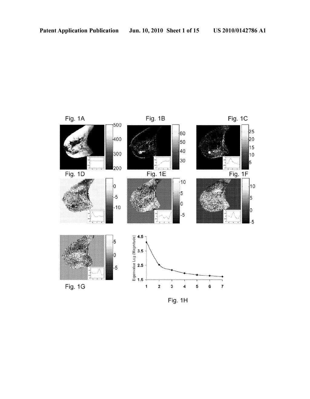 METHOD AND APPARATUS FOR COMPUTER-AIDED DIAGNOSIS OF CANCER AND PRODUCT - diagram, schematic, and image 02