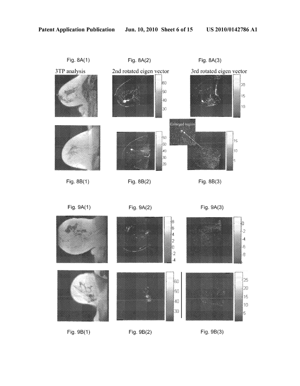 METHOD AND APPARATUS FOR COMPUTER-AIDED DIAGNOSIS OF CANCER AND PRODUCT - diagram, schematic, and image 07