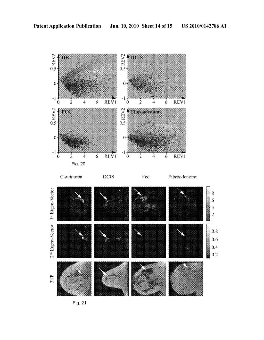 METHOD AND APPARATUS FOR COMPUTER-AIDED DIAGNOSIS OF CANCER AND PRODUCT - diagram, schematic, and image 15