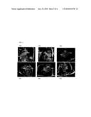 Method and System for Left Ventricle Detection in 2D Magnetic Resonance Images Using Ranking Based Multi-Detector Aggregation diagram and image