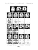 2D PARTIALLY PARALLEL IMAGING WITH K-SPACE SURROUNDING NEIGHBORS BASED DATA RECONSTRUCTION diagram and image