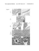 FIG4 GENE MUTATIONS IN NEURODEGENERATION diagram and image