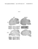 FIG4 GENE MUTATIONS IN NEURODEGENERATION diagram and image