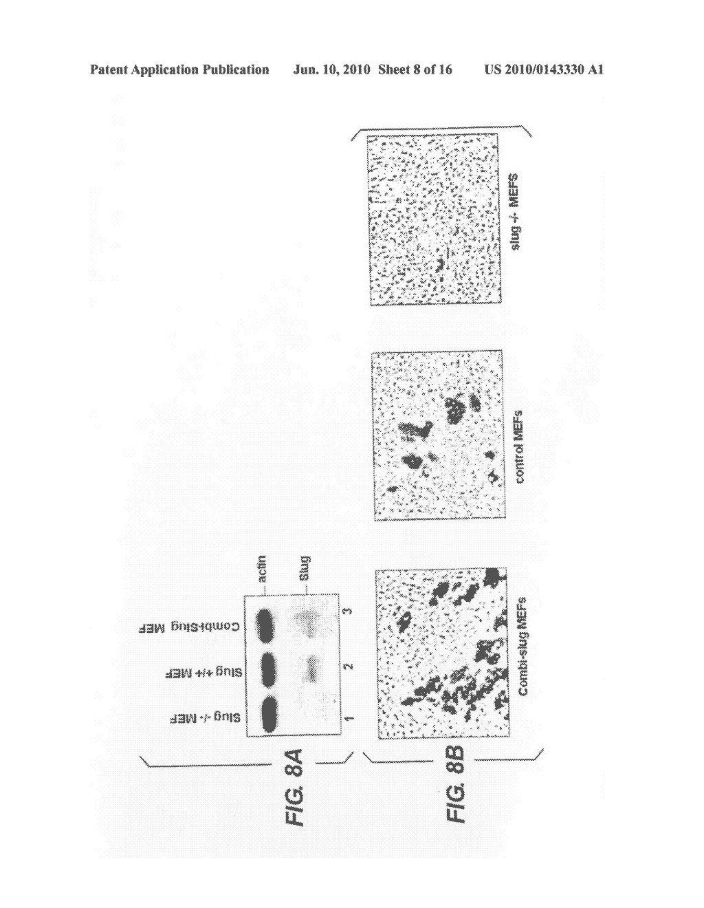 METHODS OF TREATING DISORDERS ASSOCIATED WITH FAT STORAGE - diagram, schematic, and image 09