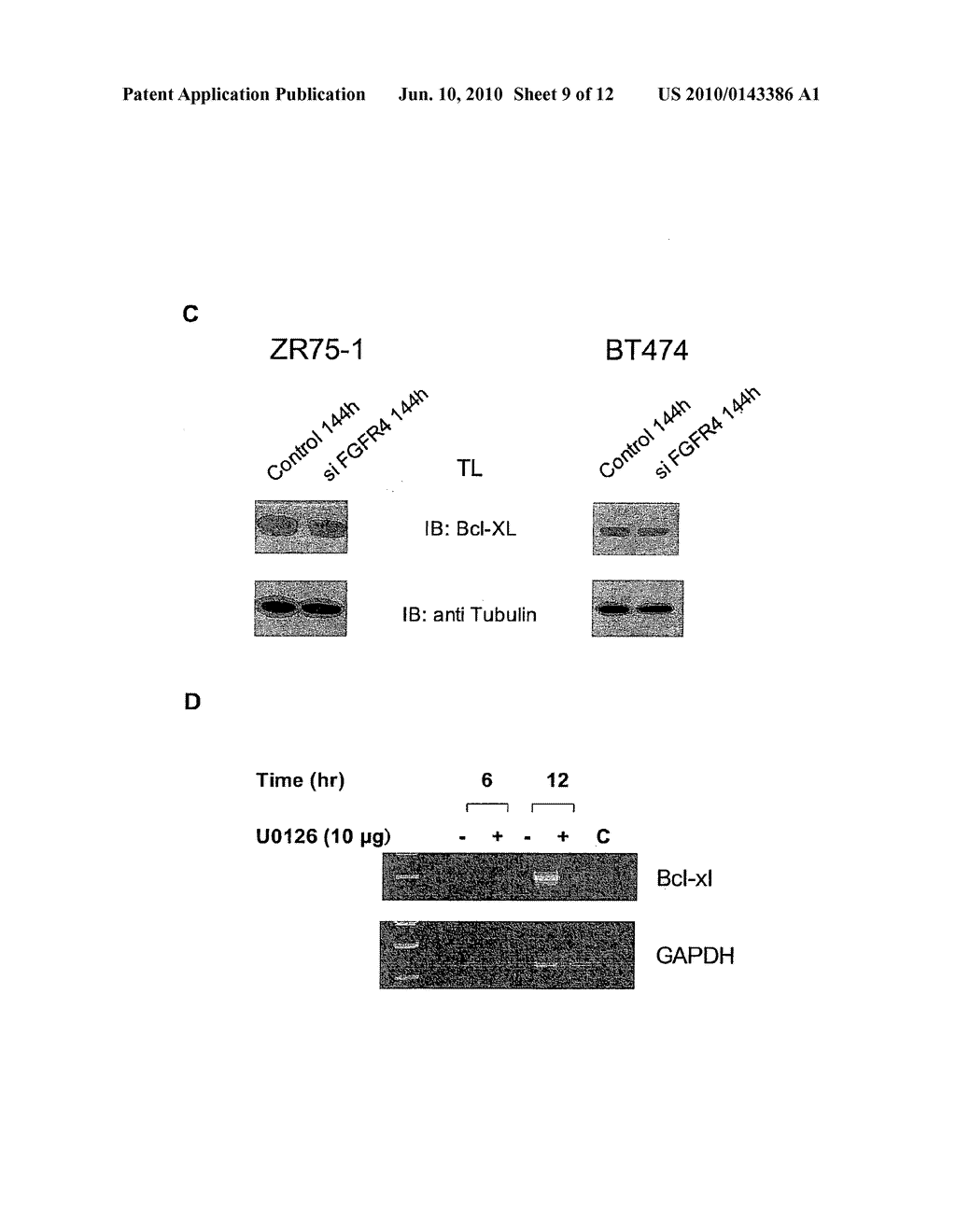 FGFR4 Promotes Cancer Cell Resistance in Response to Chemotherapeutic Drugs - diagram, schematic, and image 10