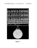 CROSS-LINKED ALGINATE-POLYALKYLENE GLYCOL POLYMER COATINGS FOR ENCAPSULATION AND METHODS OF MAKING THE SAME diagram and image