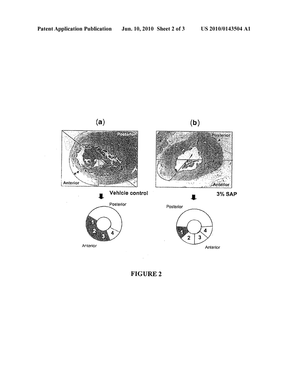 COMPOSITIONS AND METHODS FOR CARDIAC TISSUE PROTECTION AND REGENERATION - diagram, schematic, and image 03