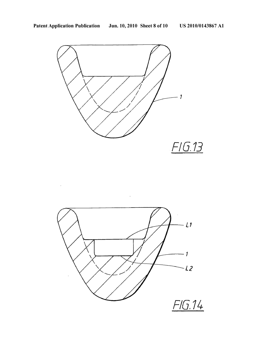  METHOD FOR PRODUCING A DENTAL RESTORATION - diagram, schematic, and image 09