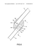 Assembly-Type Toy Stroller diagram and image