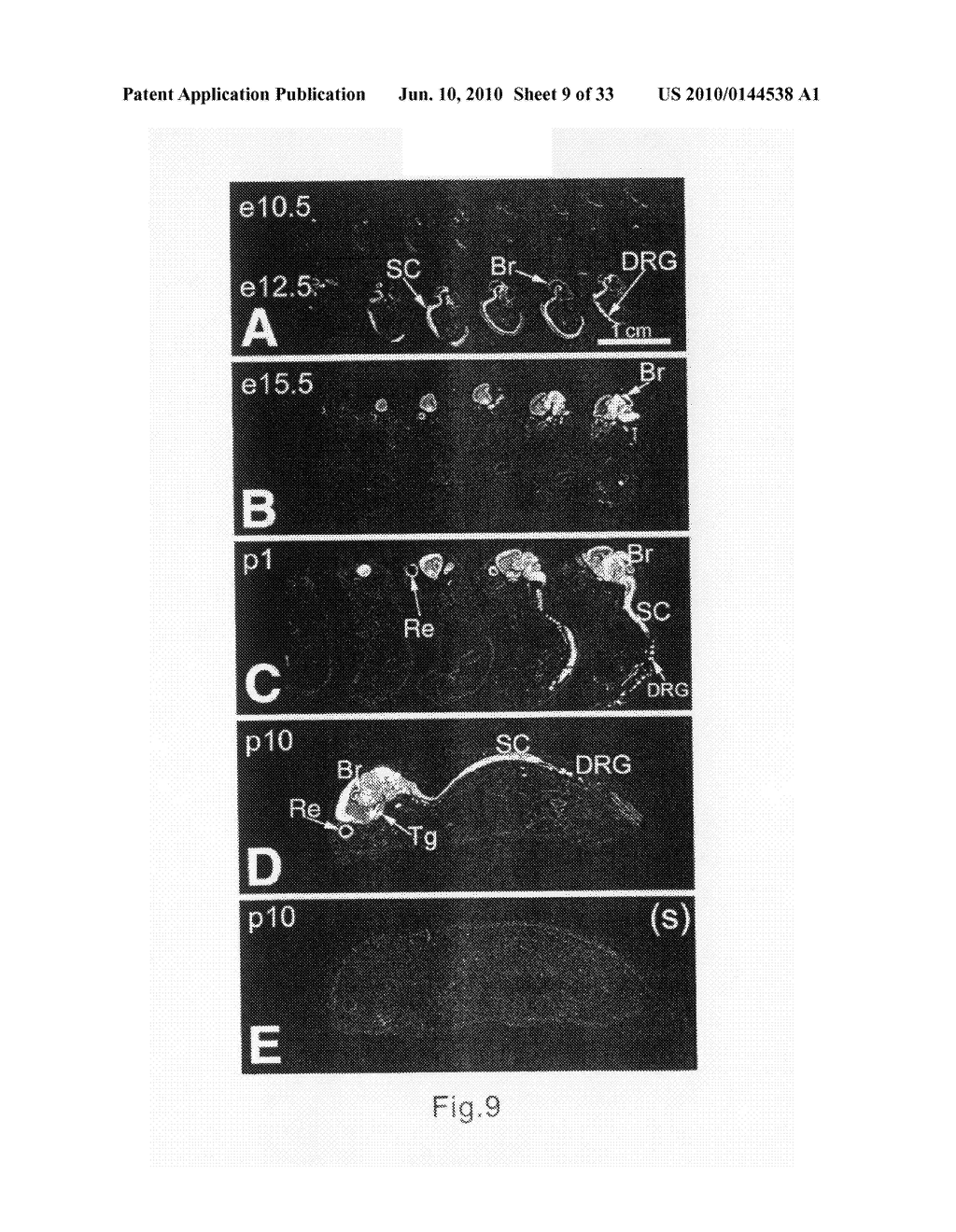 GENEMAP OF THE HUMAN GENES ASSOCIATED WITH SCHIZOPHRENIA - diagram, schematic, and image 10