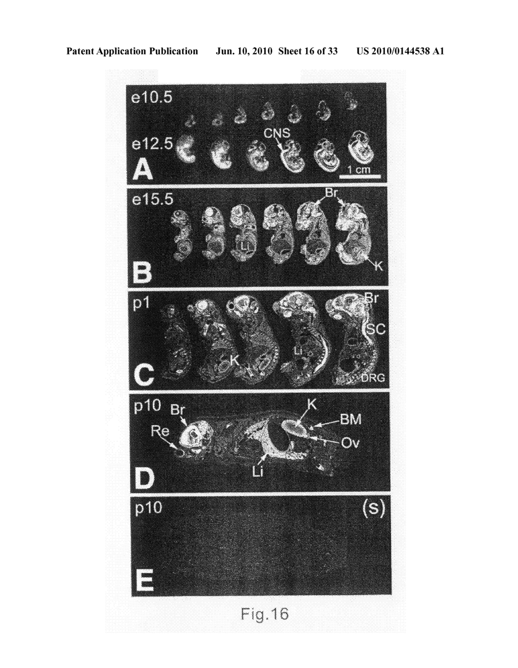 GENEMAP OF THE HUMAN GENES ASSOCIATED WITH SCHIZOPHRENIA - diagram, schematic, and image 17