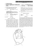 IMPLANTABLE HEART ASSIST SYSTEM AND METHOD OF APPLYING SAME diagram and image