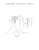 IMPLANTABLE HEART ASSIST SYSTEM AND METHOD OF APPLYING SAME diagram and image