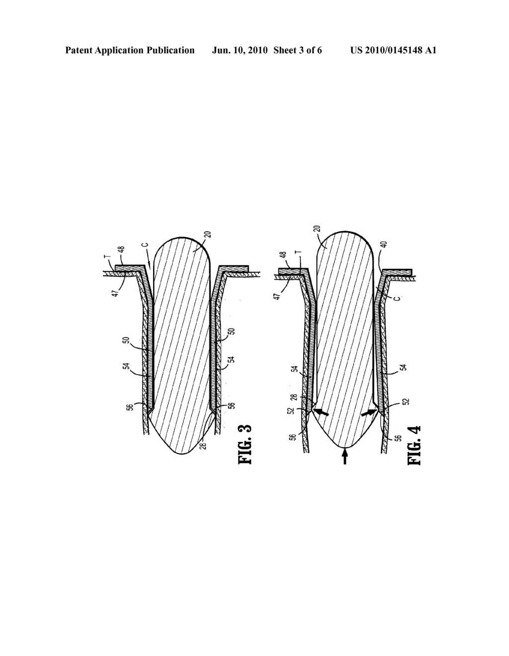 ANOSCOPE - diagram, schematic, and image 04