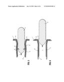 ANOSCOPE diagram and image