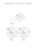 RETRACTING EYE DRAPE diagram and image