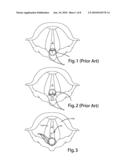 NERVE MONITORING DEVICE diagram and image