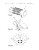 NERVE MONITORING DEVICE diagram and image