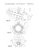 NERVE MONITORING DEVICE diagram and image