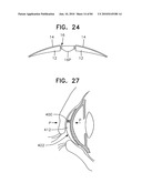 Apparatus for physical measurements of the eye diagram and image