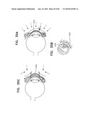 Apparatus for physical measurements of the eye diagram and image