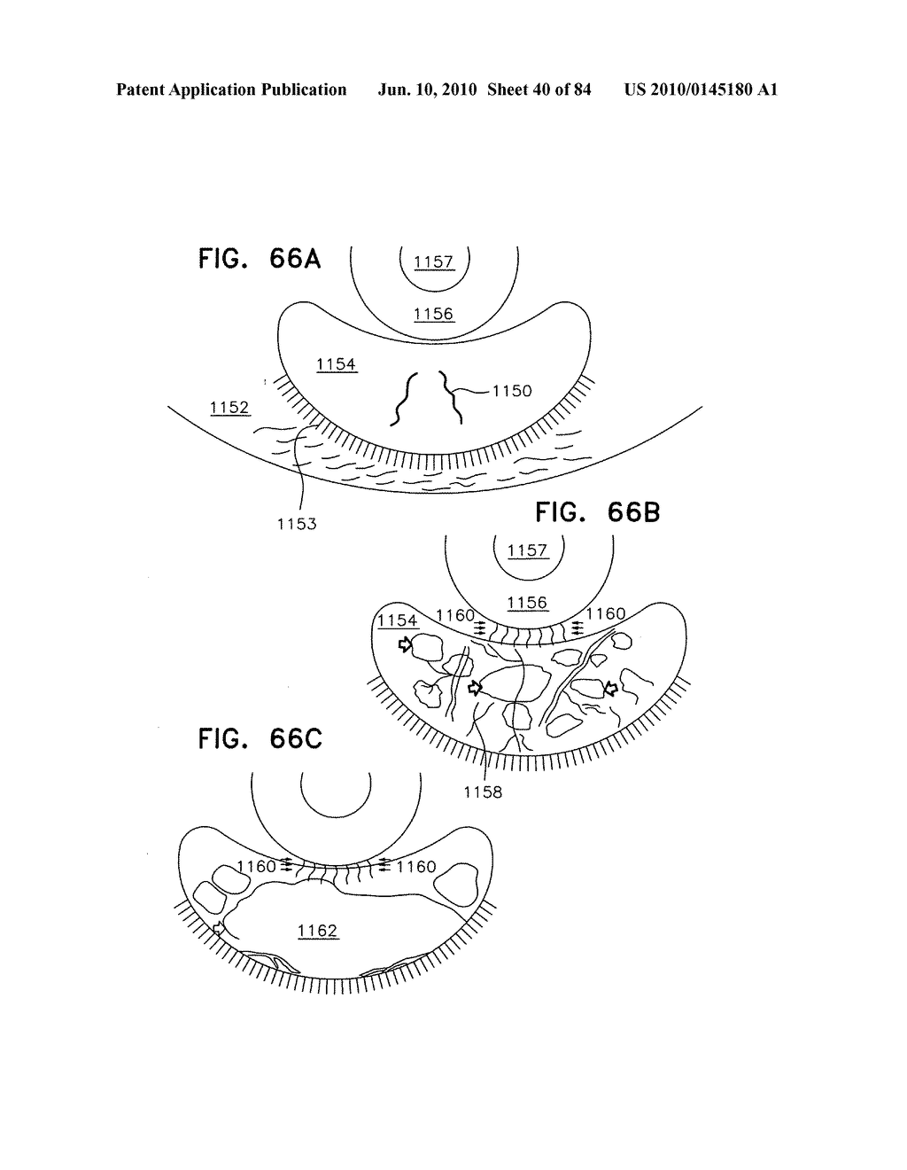 Apparatus for physical measurements of the eye - diagram, schematic, and image 41