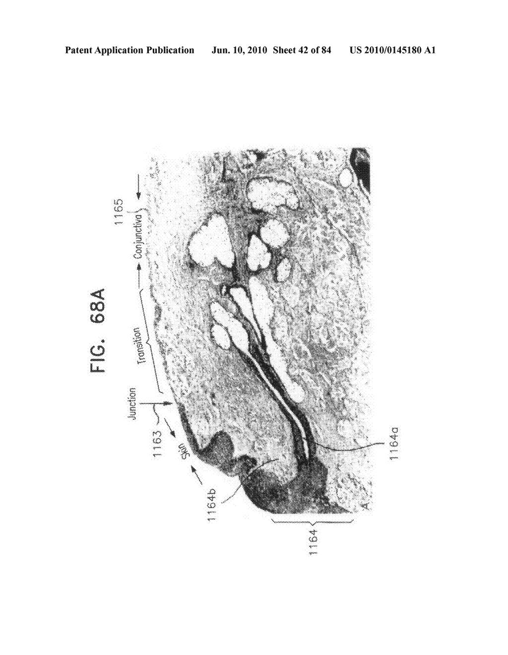 Apparatus for physical measurements of the eye - diagram, schematic, and image 43