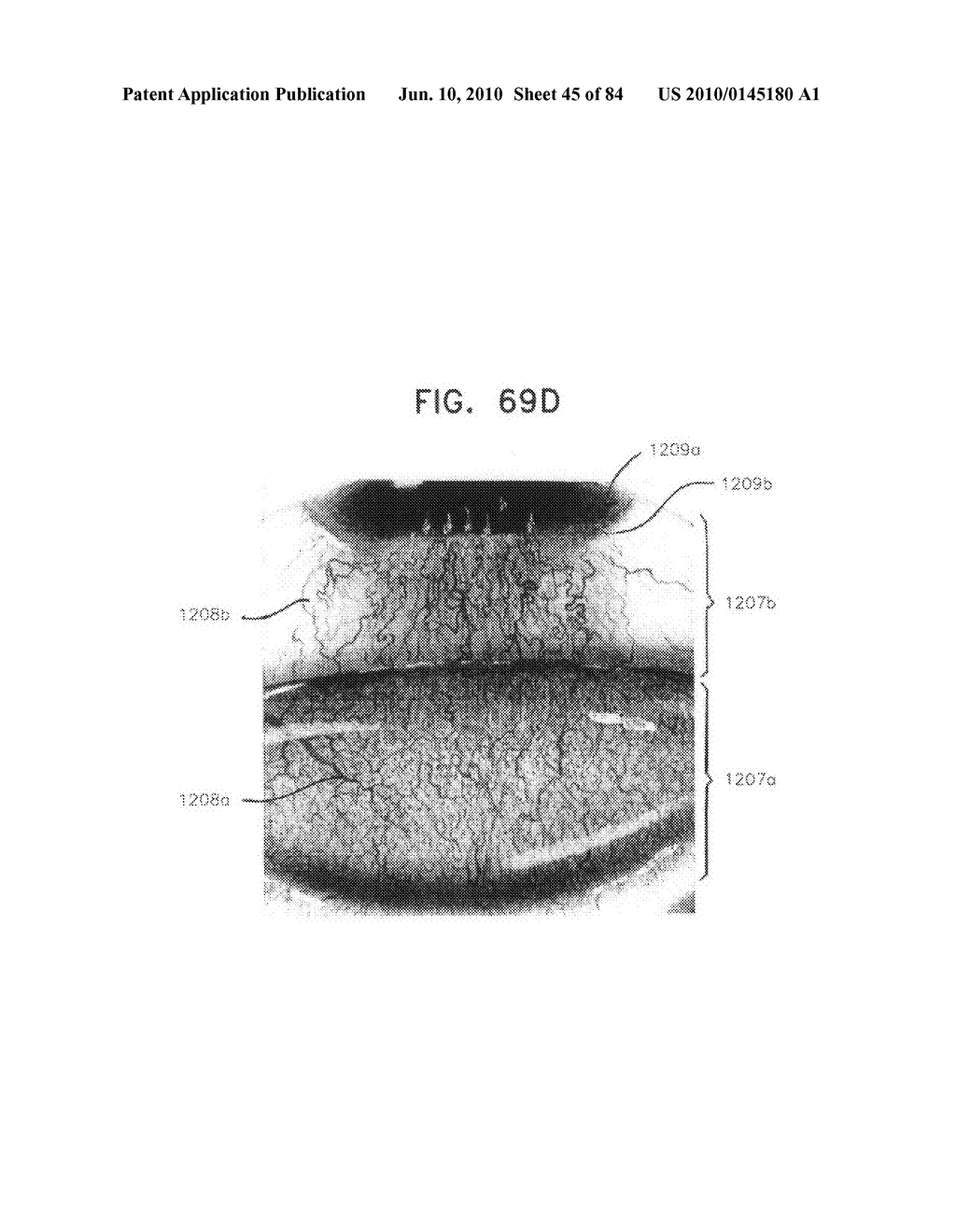 Apparatus for physical measurements of the eye - diagram, schematic, and image 46