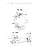 Apparatus for physical measurements of the eye diagram and image