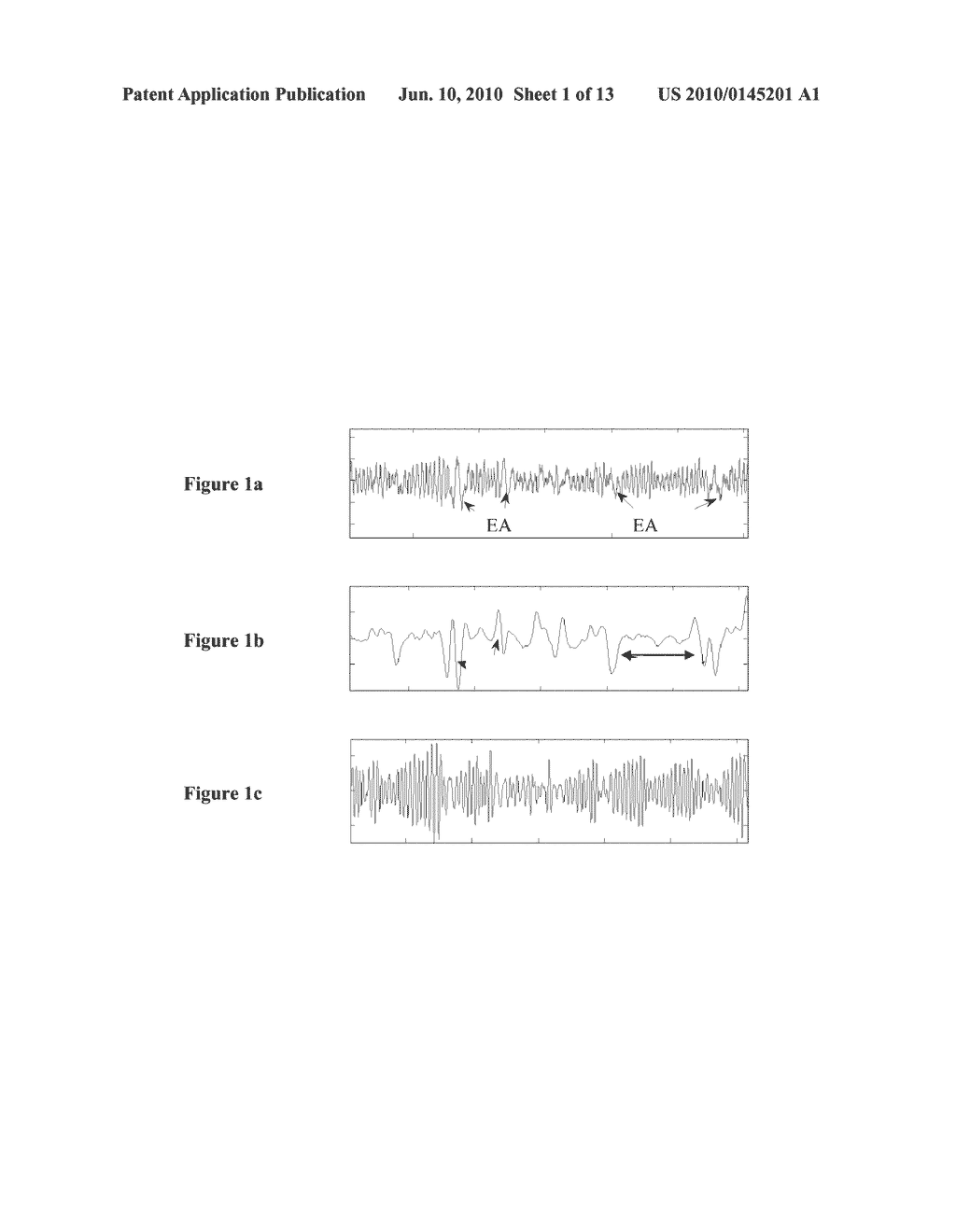 METHOD FOR MEASURING CENTRAL VENOUS PRESSURE OR RESPIRATORY EFFORT - diagram, schematic, and image 02