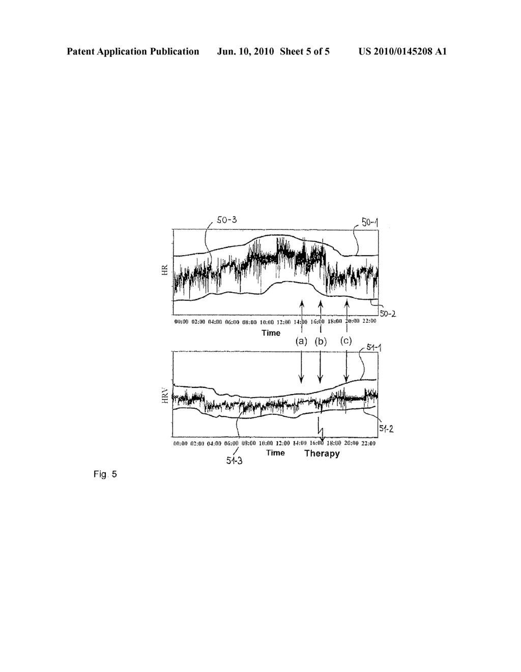 Device For Predicting Tachyarrhythmias And/Or Atrial Arrhythmias - diagram, schematic, and image 06