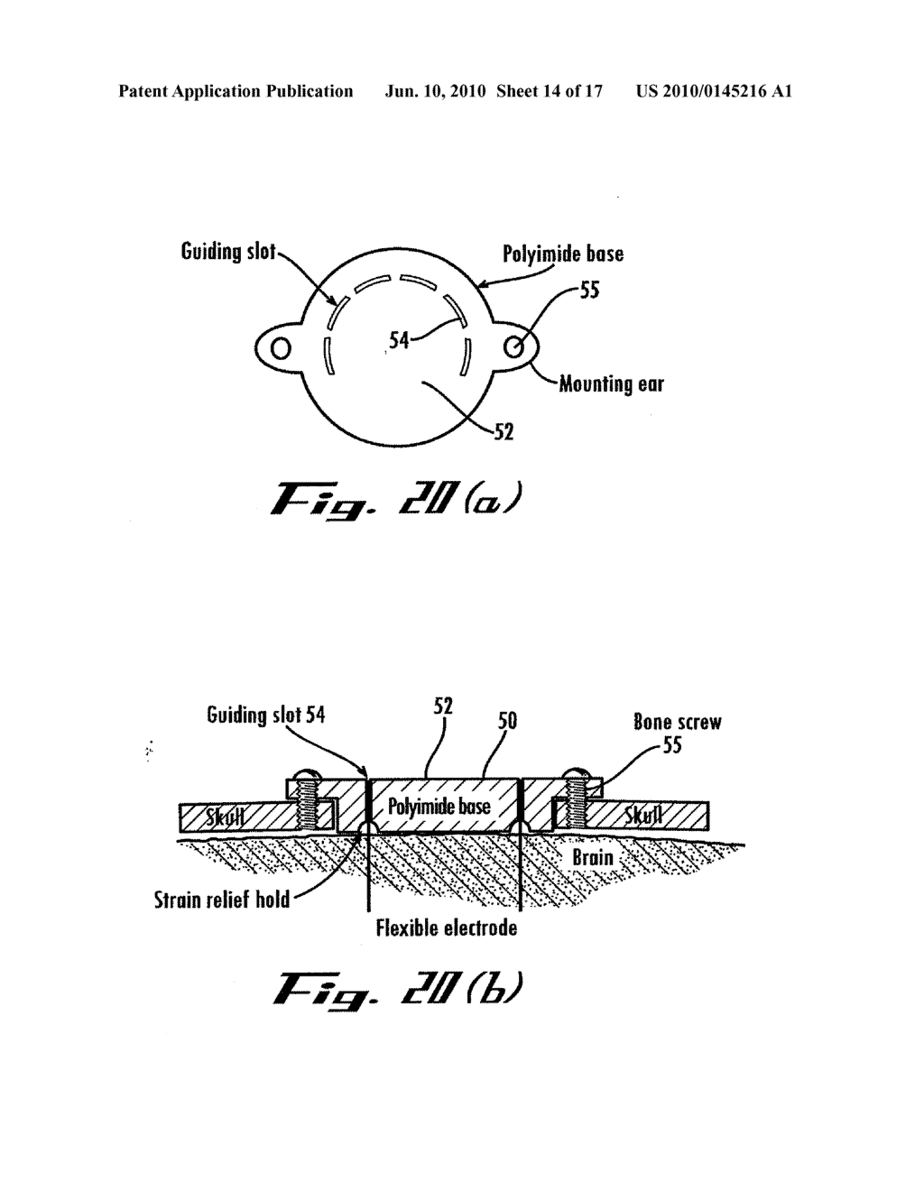 Neural Interface Assembly and Method For Making and Implanting The Same - diagram, schematic, and image 15