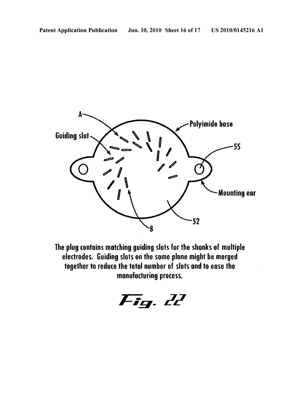 Neural Interface Assembly and Method For Making and Implanting The Same - diagram, schematic, and image 17