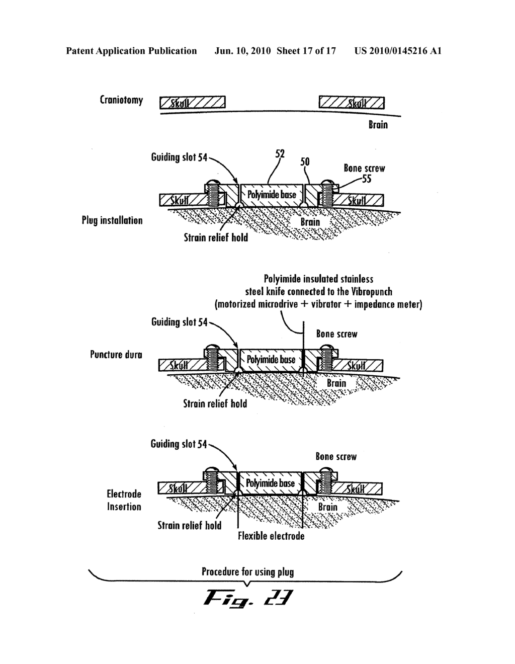 Neural Interface Assembly and Method For Making and Implanting The Same - diagram, schematic, and image 18