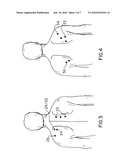 Apparatus for application of trigger point pressure in personal fitness centers and the like before or after exercise diagram and image